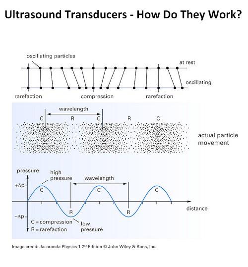 Ultrasound Transducers - How Do they Work